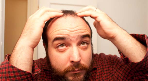 Recent Studies Show a Connection between Male Baldness and Heart Disease
