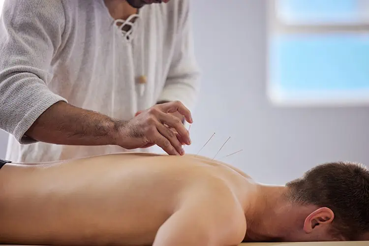 benefits of acupuncture