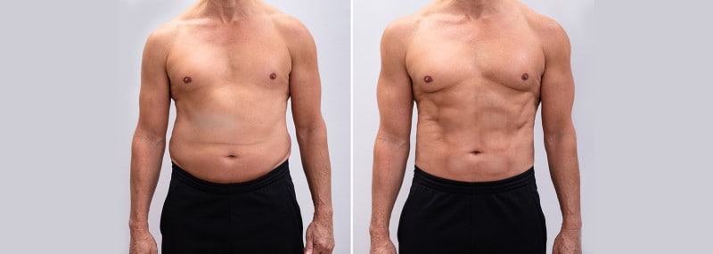 before and after weight loss