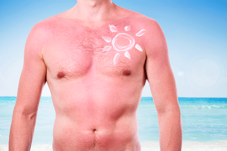 prevent or avoid skin cancer