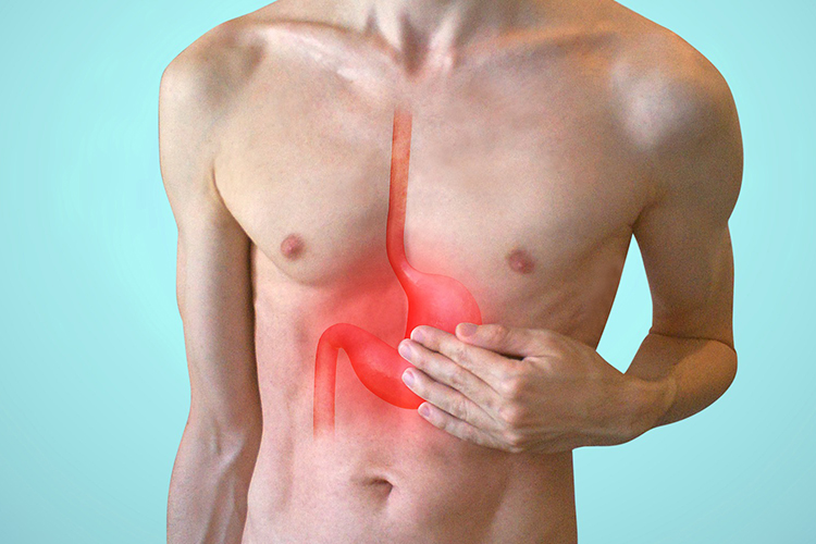 acid reflux conditions made worse by extreme stress